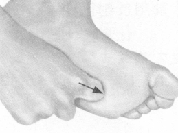 风湿病按摩部位图解