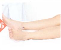 补肾强腰拔罐部位图解