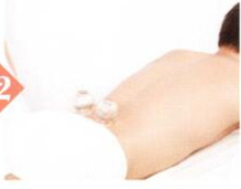 尿潴留拔罐部位图解