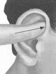 腰椎间盘突出症按摩部位图解