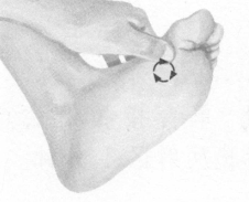 鼻炎按摩部位图解