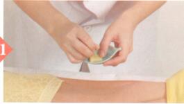 荨麻疹艾灸哪个部位图解