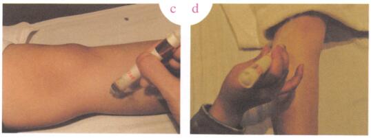 消除眼袋艾灸哪个部位图解