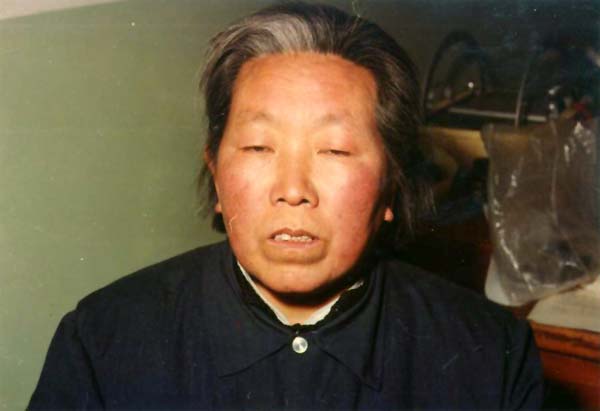 中医望色之面赤色聚