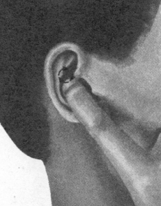 耳鸣-耳痛按摩部位图解