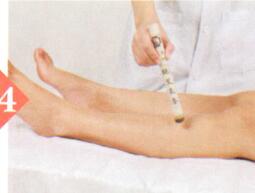 子宫脱垂艾灸哪个部位图解