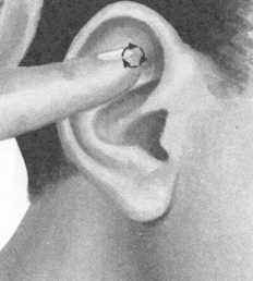 更年期综合征按摩部位图解