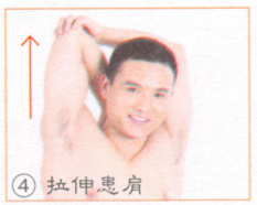 肩周炎按摩部位图解