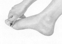 风湿病按摩部位图解