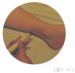 祛除雀斑艾灸哪个部位图解