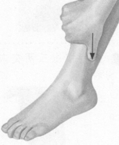 更年期综合征按摩部位图解