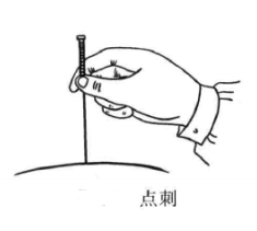 火针疗法的进针方法