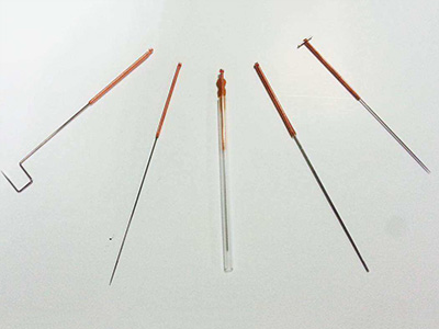 刃针针刺穴位治疗慢性前列腺炎