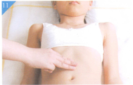 小儿近视按摩部位图解