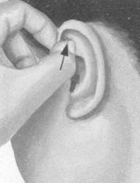 肥胖症按摩部位图解