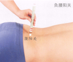 急性腰扭伤艾灸哪个部位图解