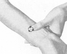 颈椎病按摩部位图解