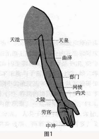 乳腺增生磁圆梅针疗法