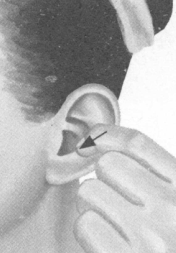 肥胖症按摩部位图解