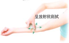 疖病-痈肿刮痧部位图解