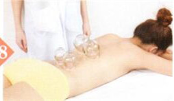 梅尼埃综合征拔罐部位图解