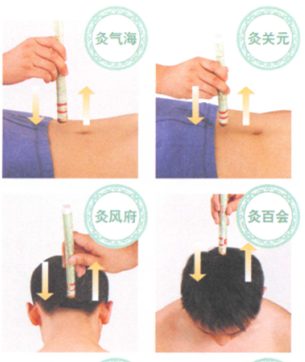 动脉粥样硬化艾灸哪个部位图解