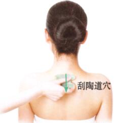 湿疹刮痧部位图解