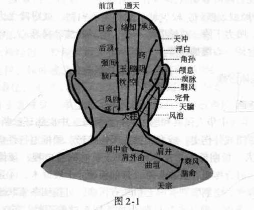 颈椎病磁圆梅针疗法