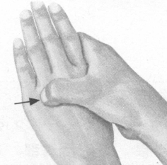 风湿病按摩部位图解