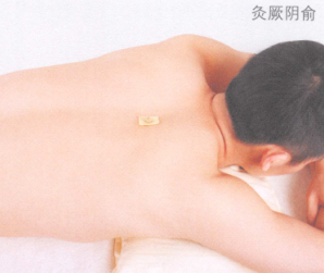 心律失常艾灸哪个部位图解