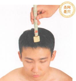 头痛艾灸哪个部位图解