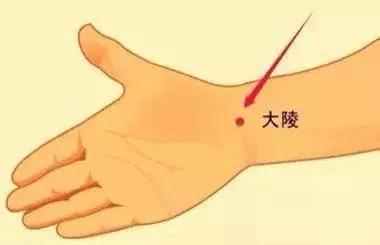 针灸大陵穴治鼠标手
