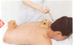 甲亢艾灸哪个部位图解