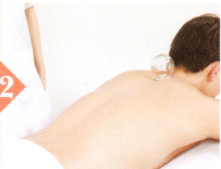 高血脂拔罐部位图解