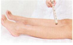 牛皮癣艾灸哪个部位图解