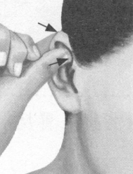 胃肠炎按摩部位图解