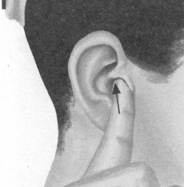 鼻炎按摩部位图解