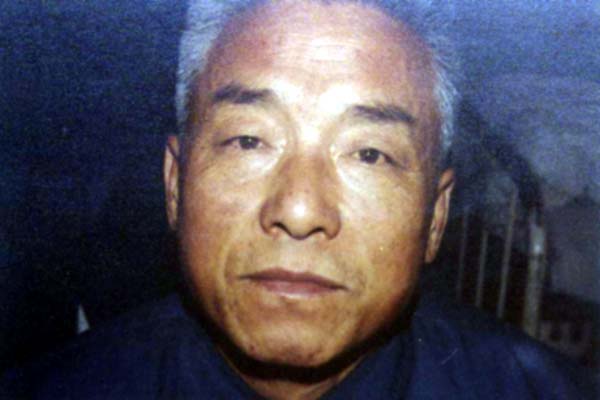 中医望色之黧黑阴黄