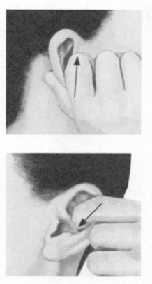 冠心病按摩部位图解