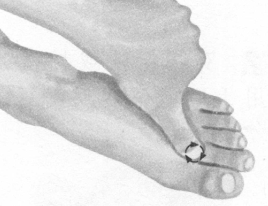 鼻炎按摩部位图解