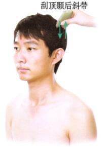 风湿性关节炎刮痧部位图解