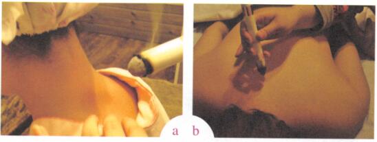 关节疼痛艾灸哪个部位图解