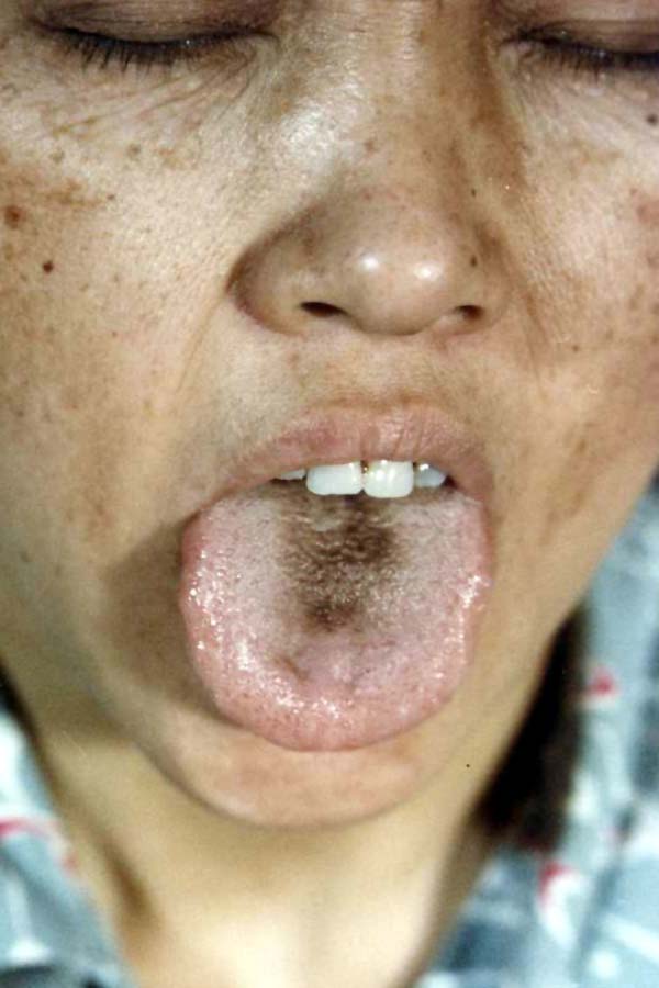 中医望色之面色苍白而浊