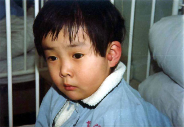 中医望耳之山根青黄，耳前生瘤