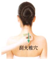 肩周炎刮痧部位图解