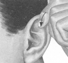 风湿病按摩部位图解