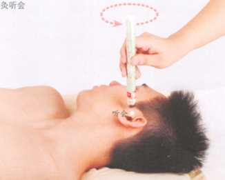 耳聋艾灸哪个部位图解