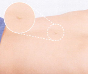 老年性白内障艾灸哪个部位图解