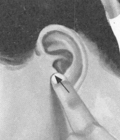 鼻炎按摩部位图解