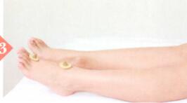 荨麻疹艾灸哪个部位图解